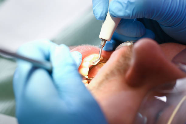 Best Weekend Emergency Dentist in Olga, FL